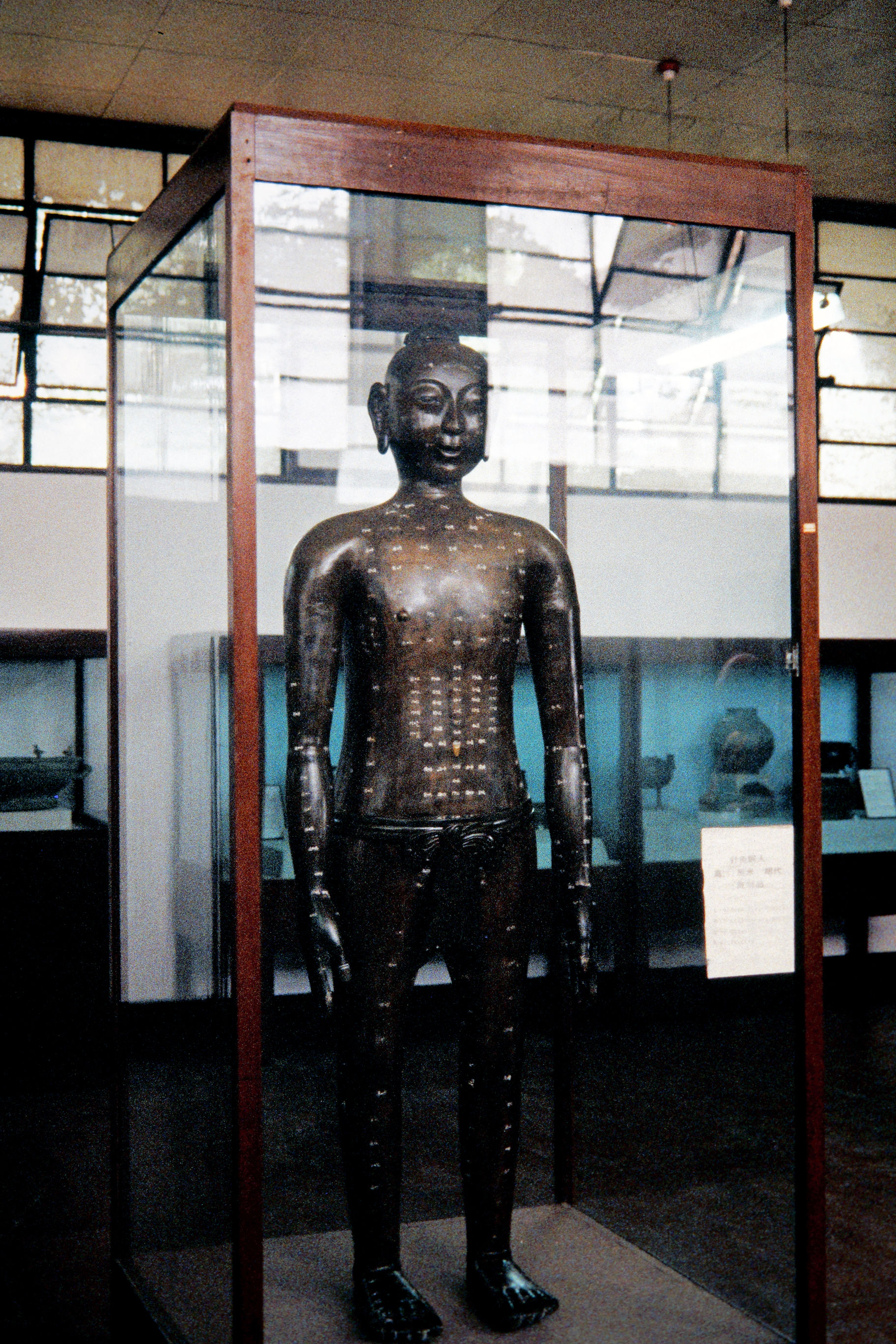 Im Museum–Akkupunkturfigur